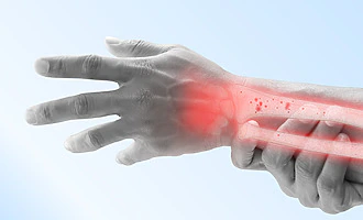Ilustrace tématu Osteoporóza